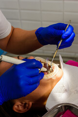 The dentist removes tartar using ultrasound, the patient at the dentist. Retractor for isolation of lips and gums.