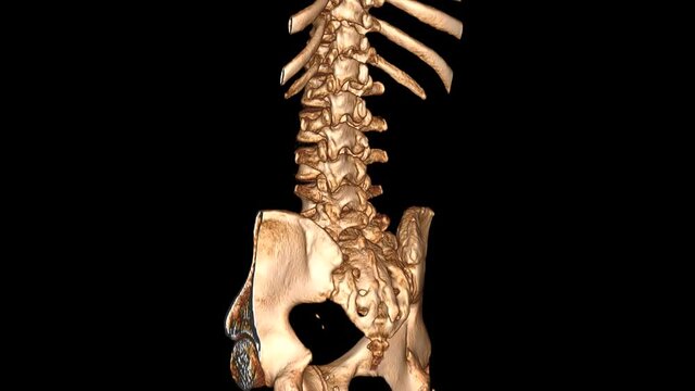CT scan reconstruction. Lover part of human spine and pelvis. 3D rendering
