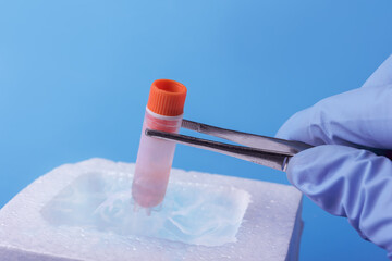 Cryopreservation of sample in laboratory. Scientist hold test tube. A liquid nitrogen bank...