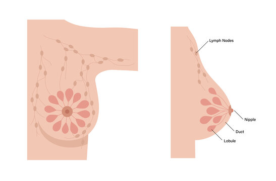 Breast disease concept