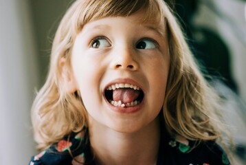 young girl with wobbly tooth pulling faces showing her tooth