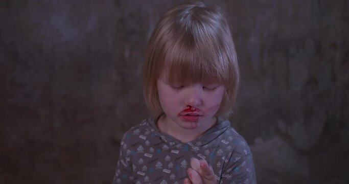 blond boy covered in blood. child has weak vessels in nose, bursting with pressure drops and changes in weather. Hemophilia disease.  kid raises her head to stop bleeding