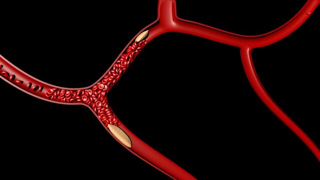 3d clot thrombus for medical health on black 4k
