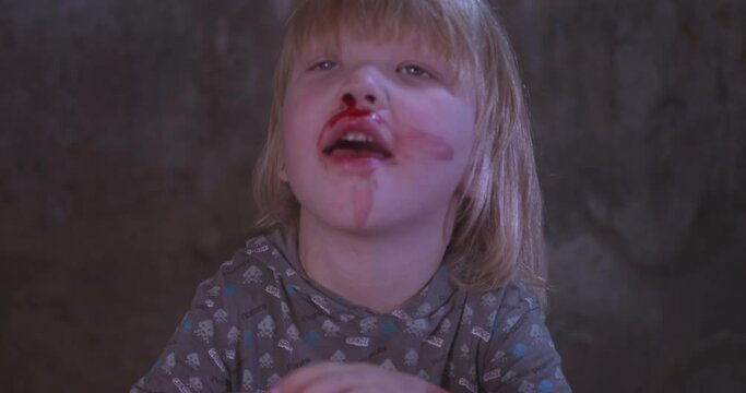 blond boy covered in blood. child has weak vessels in nose, bursting with pressure drops and changes in weather. Hemophilia disease.  kid raises her head to stop bleeding