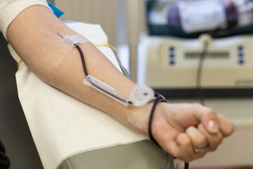 Fototapeta premium in hand of woman a needle in vein and blood transfusion system. soft focus