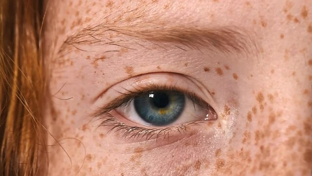 Blue eye of a red-haired girl with lots of freckles on the face, looking into the camera. Close up