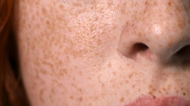 Red haired girl with lots of freckles on the face and blue eyes looking into the camera. White background. Close up
