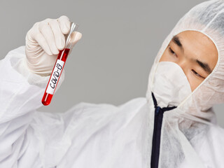 A male laboratory assistant holds in his hands analyzes research diagnostics 