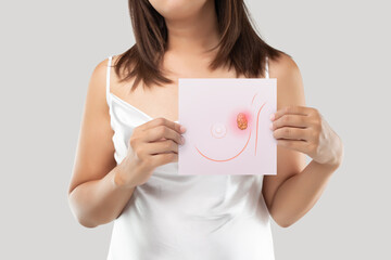 A woman holding a light pink paper with the breast cancer cells picture. Breast tissue. The concept...
