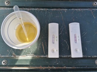 Medical examination kit, drug test kit in the urine.