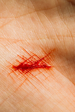 Fresh bloody cut on human hand