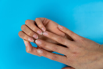 Female hands with nails affected by fungus on a blue background. Hand health and hygiene.