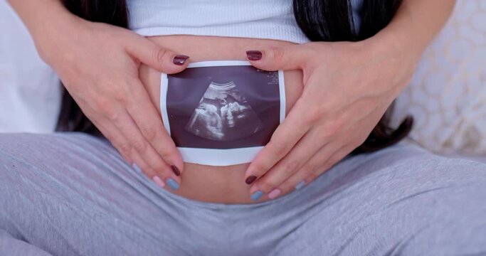 Close-up, baby's ultrasound photograph, pregnant woman holding her baby's ultrasound photograph on her belly. Family values, mother's love. Zoom out of the camera. 4k, ProRes
