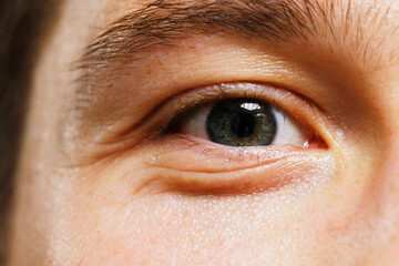 Close-up picture of blue eye from a young man