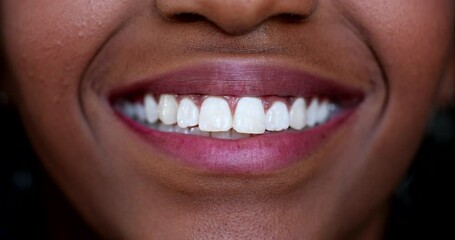 Black girl mouth smiling macro close-up white teeth, african ethnicity