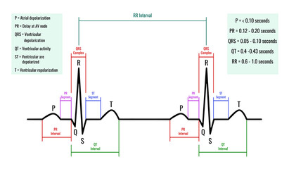 illustration of ECG interpretation. ECG of a healthy person.Useful for educating doctors and nurses.