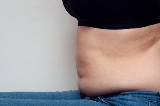 Overweight fat woman showing her belly fat side view