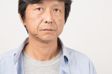 顔にシワ、シミがある中年男性