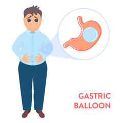 Overweight male patient undergoing gastric balloon 
procedure for weight loss. Stomach of a man filled with intragastiс balloon. Health care and medical concept. Vector illustration in flat style.