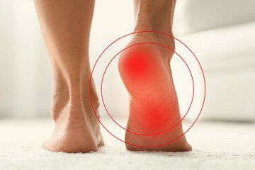 Woman suffering from foot pain at home, closeup
