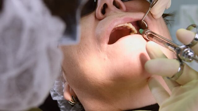 Dentist making local anaesthesia shot before surgery. Senior woman at dental clinic. Dentist with assistant install implant in a patient mouth in modern dental office