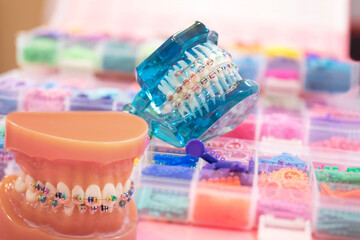 orthodontic model and dentist tool - demonstration teeth model of varities of orthodontic bracket or brace
