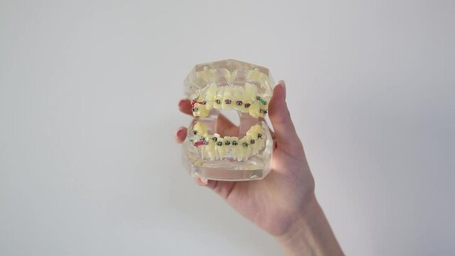 Dental examinations, dental cleaning systems, with braces, shows the dentist