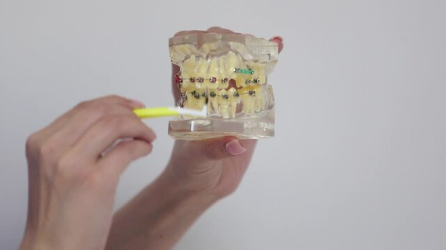 Dental examinations, dental cleaning systems, with braces, shows the dentist