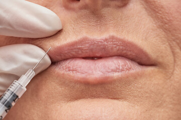 Obraz premium Beuty concept. Close up shot of a woman making lip augmentation procedure by cosmetologist