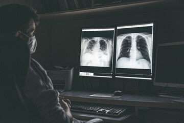Radiologist looking at image of lungs of patient with coronavirus Covid-19