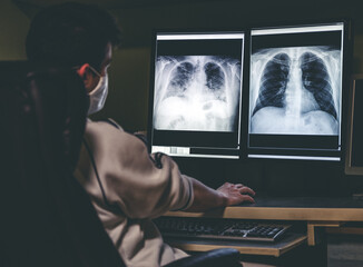 Doctor looking at x-ray image of lungs of patient with coronavirus Covid-19