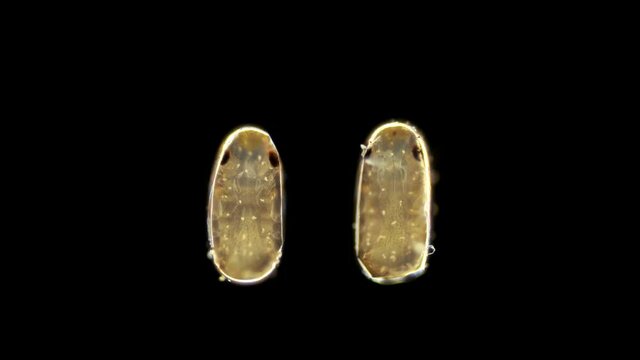 insect eggs under a microscope, type Arthropoda, oblong. A formed larva can be seen, which will soon leave the shell