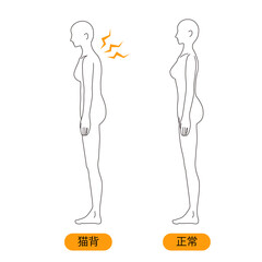 女性　メディカル　姿勢（猫背） 美容　裸　ヌード　全身　横