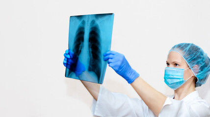 Woman doctor with lung x-ray, fluorography, x-ray on light background. A female doctor in a medical uniform (coat). Medical staff, medicine concept. Pneumonia.