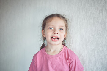 Naklejka premium little girl with fallen out front and teeth, portrait of a child on a white background.