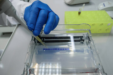 protein electrophoresis