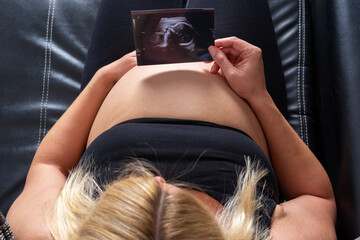 Draufsicht auf eine schwangere Frau, die vor ihrem nackten Babybauch ein Ultaschallfoto hält