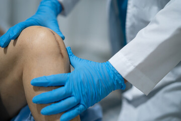 Asian senior or elderly old lady woman patient show her scars surgical total knee joint replacement...