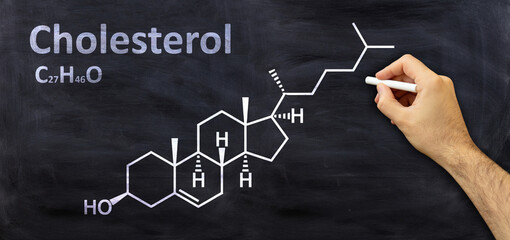 Cholesterol structural chemical formula, chalk drawing on a blackboard