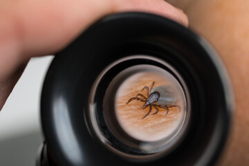 Dangerous deer tick on human skin in magnifying glass of black eyepiece. Ixodes ricinus. Small...