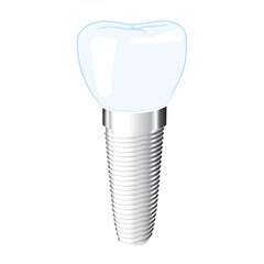Dental implant illustration isolated on white background