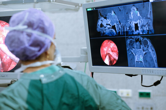Neurosurgeon in scrubs looking at monitor