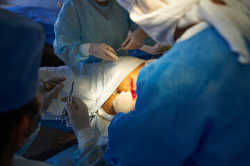 Surgery. The surgeon's assistant ties a ligature over the skin. Medical intervention.