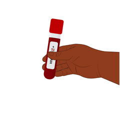 Fototapeta premium hand of an African American holding a test tube with a positive result for HIV / AIDS, vector illustration in flat style on a white background, banner, poster, educational material, textbook, clipart,