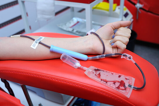 Taking blood from the vain of a donor. Arm on an armrest, hypodermic needle, tubes, container with blood