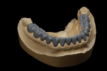 dental smile design made of wax
