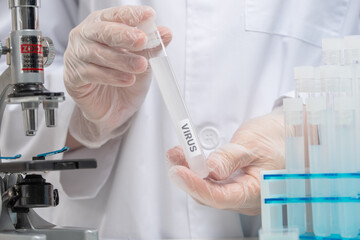 Close-up view of laboratory assistant in protective gloves holds biological tube with label virus. Laboratory background. Research of coronavirus. Healthcare and medical concept.