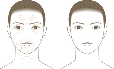 女性の顔と加齢によるシワ。