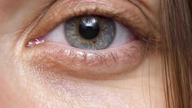 Gray and blue area surrounding pupil is iris. Woman's eyes. Wrinkle around eye is fold, ridge or crease on skin. Cosmetology and skincare