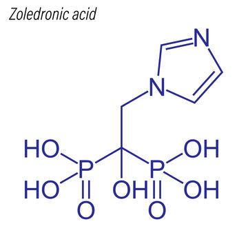 Vector Skeletal formula of Zoledronic acid. Drug chemical molecule.